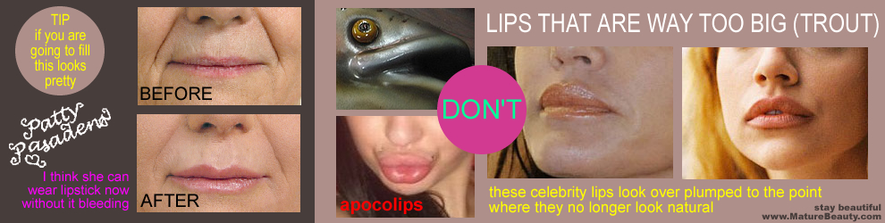 Trout Pout Lips