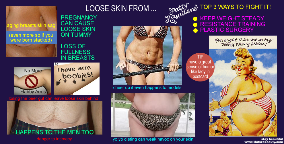 loose skin, how to get rid of loose skin, what can i do about loose skin, weight loss and loose skin, loose belly skin, abdominoplasty, renowned tummy tucks, cost of a tummy tuck, plastic surgery after pregnancy, bat wing arm flab, flabby arms, liposuction, contour body, cosmetic surgery procedure